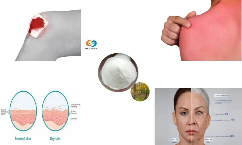 How Birch Bark Extract Enhances Skin Health and Radiance?